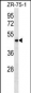 VN1R5 Antibody (Center)